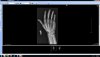 Broken Hand 01 - Copy.jpg